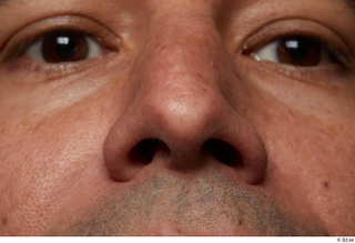 HD Face Skin Harrison Hill face nose skin pores skin…